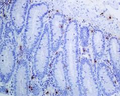 Immunohistochemistry (Formalin/PFA-fixed paraffin-embedded sections) - Anti-Mast Cell Tryptase antibody [EPR9522] - BSA and Azide free (AB271916), expandable thumbnail