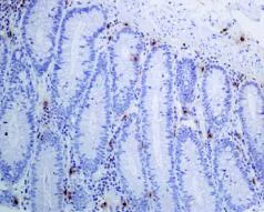 Immunohistochemistry (Formalin/PFA-fixed paraffin-embedded sections) - Anti-Mast Cell Tryptase antibody [EPR9522] - Low endotoxin, Azide free (AB216451)