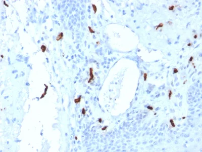 Immunohistochemistry (Formalin/PFA-fixed paraffin-embedded sections) - Anti-Mast Cell Tryptase antibody [TPSAB1/1961] - BSA and Azide free (AB237924)