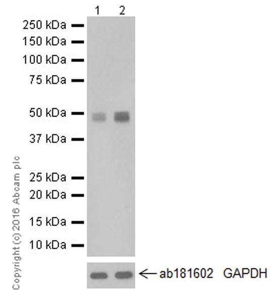 Western blot - Anti-MAT1A + MAT2A antibody [EPR19048] (ab192846), expandable thumbnail