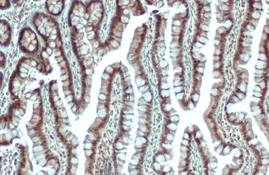 Immunohistochemistry (Formalin/PFA-fixed paraffin-embedded sections) - Anti-MAT2A antibody (AB154343)