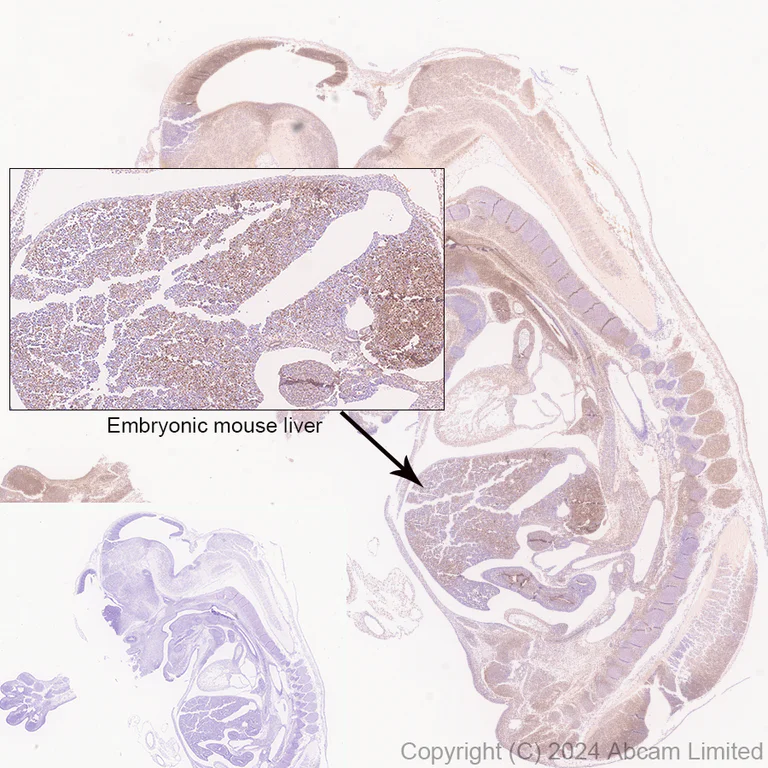 Immunohistochemistry (Formalin/PFA-fixed paraffin-embedded sections) - Anti-MAT2A antibody [EPR30426-504] (AB325713)