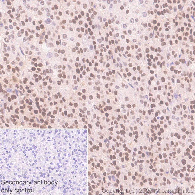 Immunohistochemistry (Formalin/PFA-fixed paraffin-embedded sections) - Anti-MAT2A antibody [EPR30426-504] (AB325713)