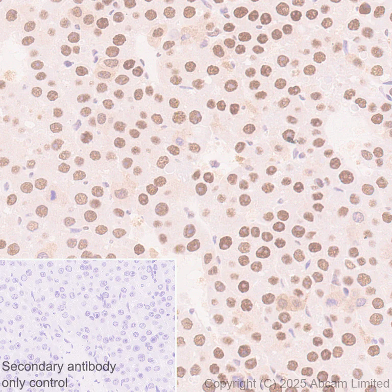 Immunohistochemistry (Formalin/PFA-fixed paraffin-embedded sections) - Anti-MAT2A antibody [EPR30426-504] (AB325713)