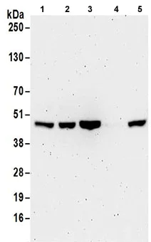 Western blot - Anti-MAT2A antibody - N-terminal (AB186129)