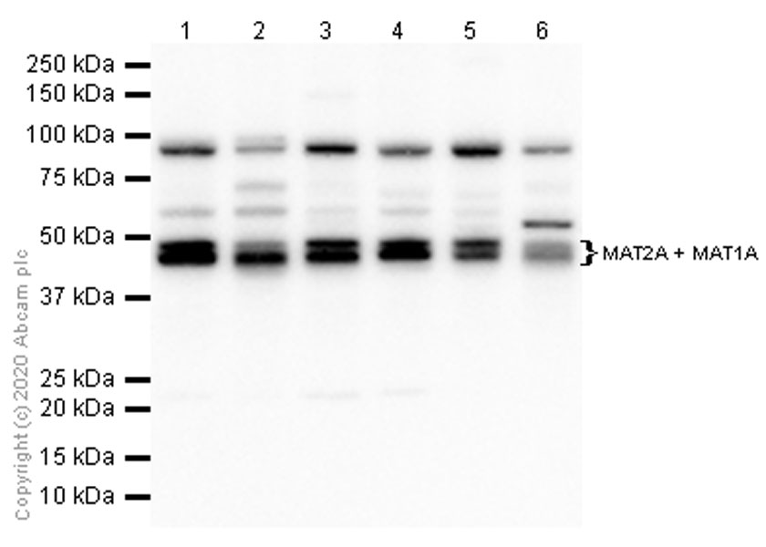 Western blot - Anti-MAT2A+MAT1A antibody [EPR10496] - BSA and Azide free (AB249988), expandable thumbnail