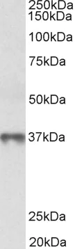 Western blot - Anti-MAT2B/TGR antibody (AB139132)