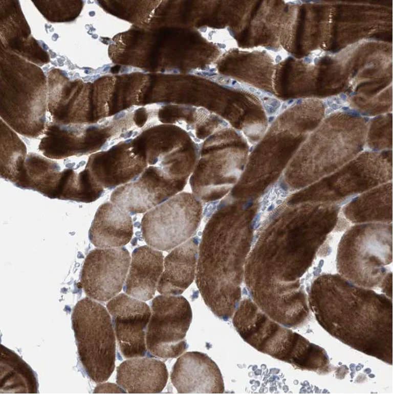 Immunohistochemistry (Formalin/PFA-fixed paraffin-embedded sections) - Anti-MATE-1 antibody (AB224440)