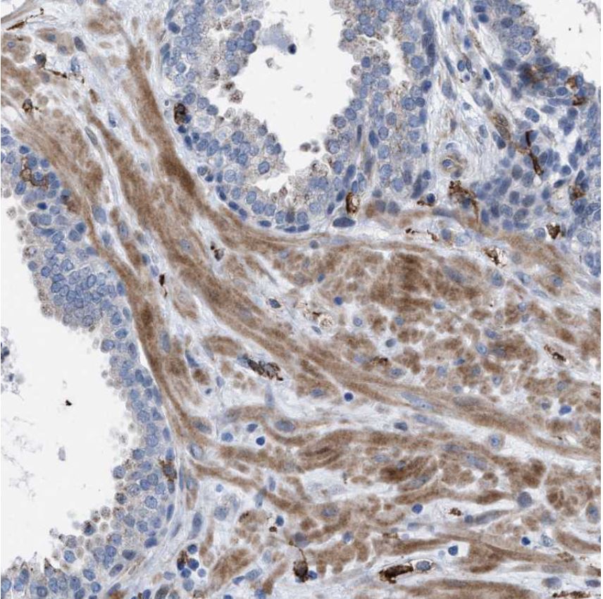Immunohistochemistry (Formalin/PFA-fixed paraffin-embedded sections) - Anti-MATE-1 antibody (AB224440), expandable thumbnail