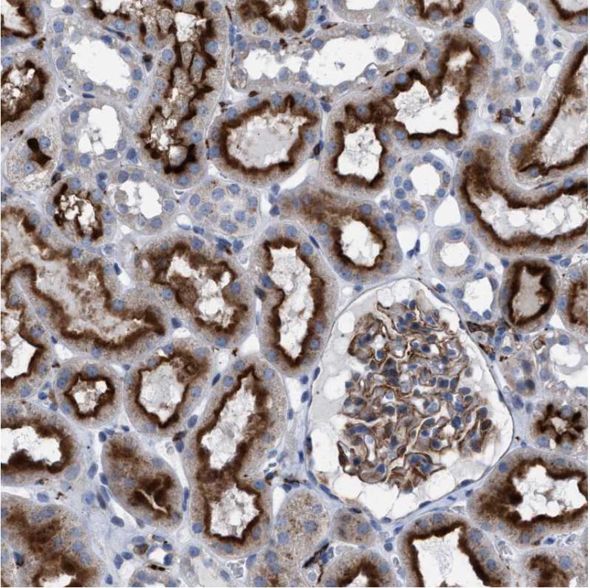 Immunohistochemistry (Formalin/PFA-fixed paraffin-embedded sections) - Anti-MATE-1 antibody (AB224440), expandable thumbnail