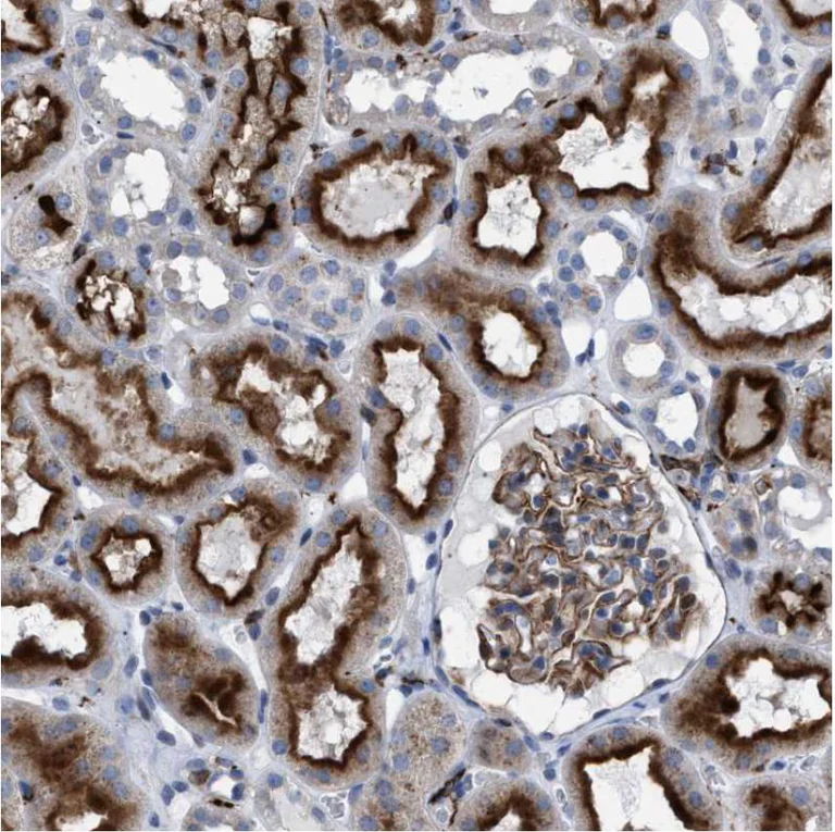 Immunohistochemistry (Formalin/PFA-fixed paraffin-embedded sections) - Anti-MATE-1 antibody (AB224440)