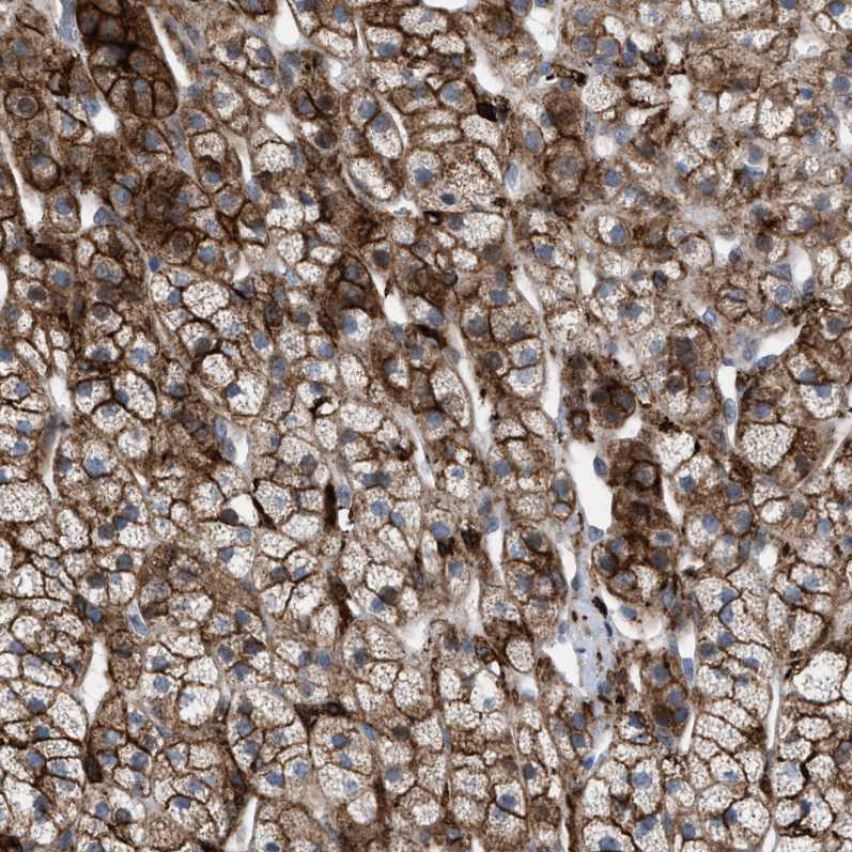 Immunohistochemistry (Formalin/PFA-fixed paraffin-embedded sections) - Anti-MATE-1 antibody (AB224440), expandable thumbnail