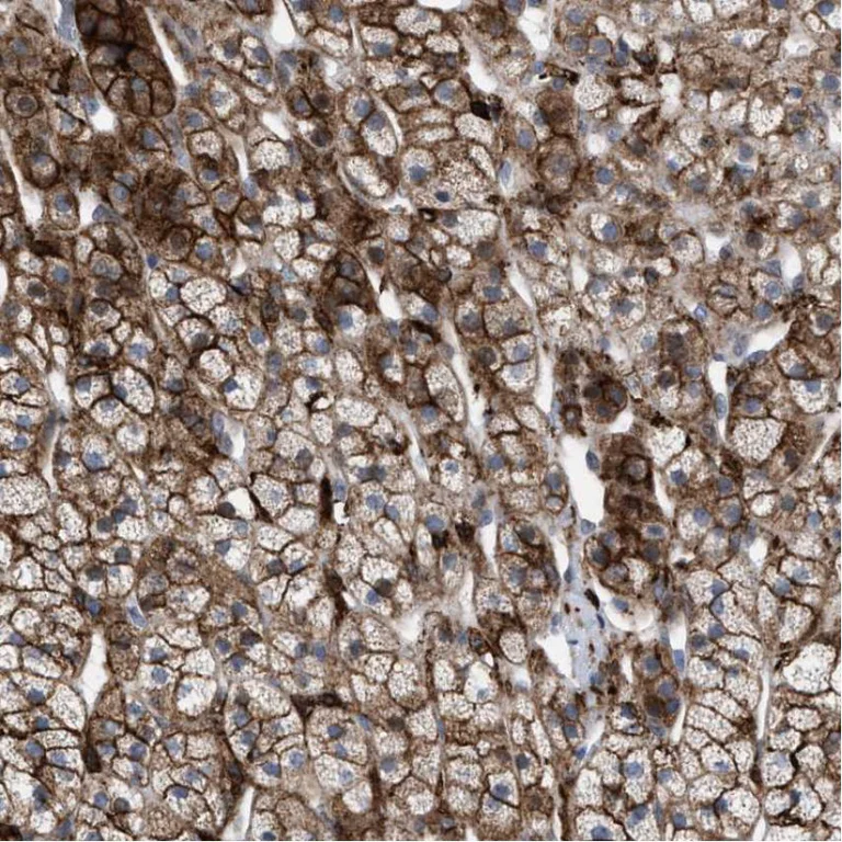 Immunohistochemistry (Formalin/PFA-fixed paraffin-embedded sections) - Anti-MATE-1 antibody (AB224440)