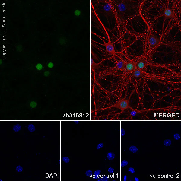 Immunocytochemistry/ Immunofluorescence - Anti-MATH2/NEUROD6 antibody [EPR28660-23] (AB315812)