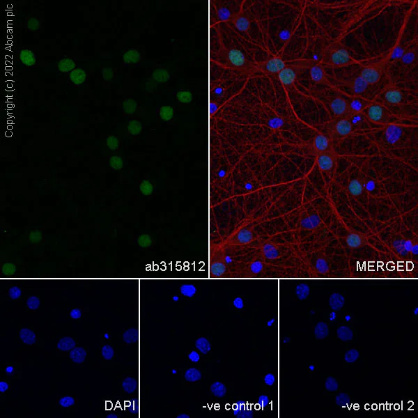 Immunocytochemistry/ Immunofluorescence - Anti-MATH2/NEUROD6 antibody [EPR28660-23] (AB315812)