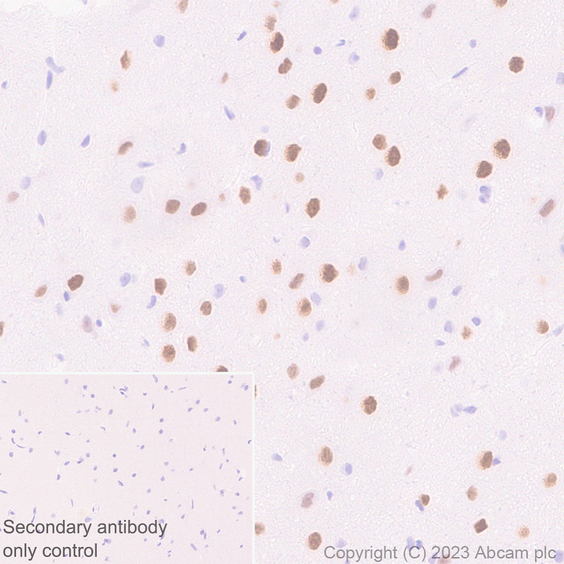 Immunohistochemistry (Formalin/PFA-fixed paraffin-embedded sections) - Anti-MATH2/NEUROD6 antibody [EPR28660-23] (ab315812), expandable thumbnail