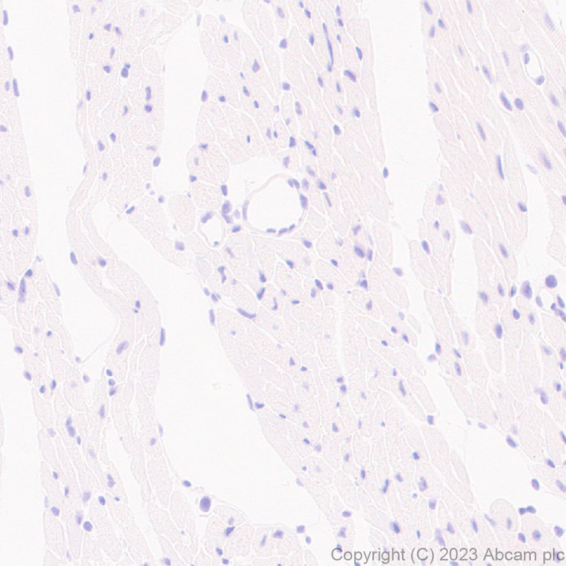 Immunohistochemistry (Formalin/PFA-fixed paraffin-embedded sections) - Anti-MATH2/NEUROD6 antibody [EPR28660-23] (ab315812), expandable thumbnail