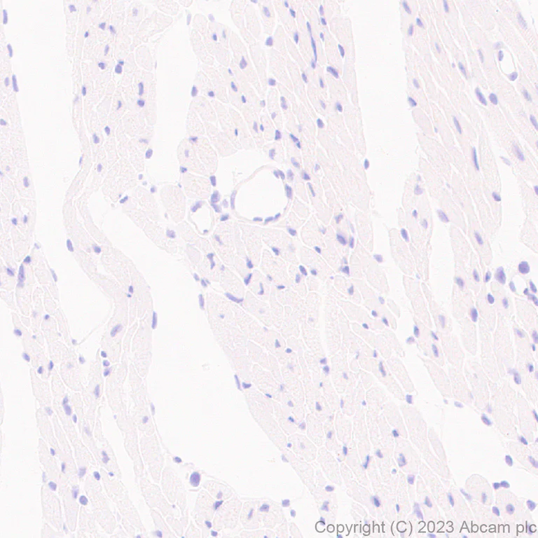 Immunohistochemistry (Formalin/PFA-fixed paraffin-embedded sections) - Anti-MATH2/NEUROD6 antibody [EPR28660-23] (AB315812)