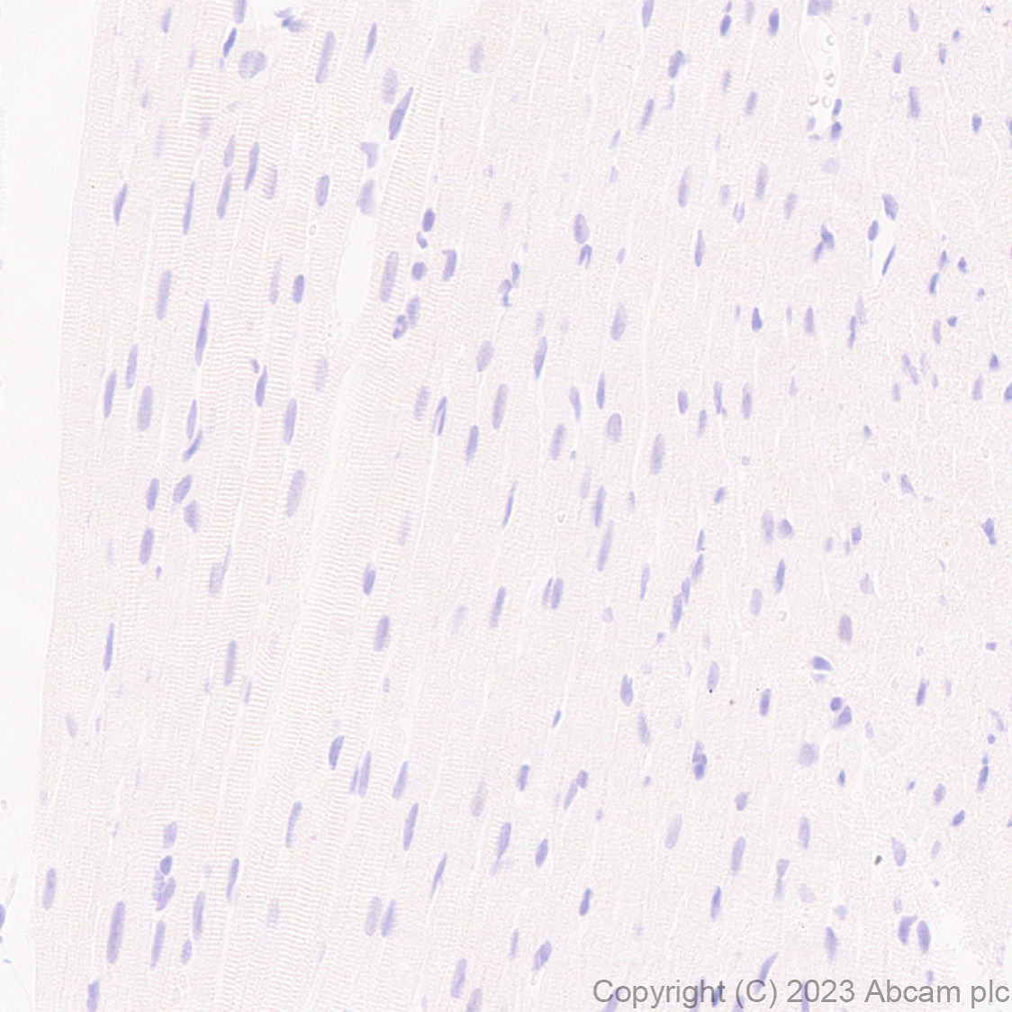 Immunohistochemistry (Formalin/PFA-fixed paraffin-embedded sections) - Anti-MATH2/NEUROD6 antibody [EPR28660-23] (ab315812), expandable thumbnail