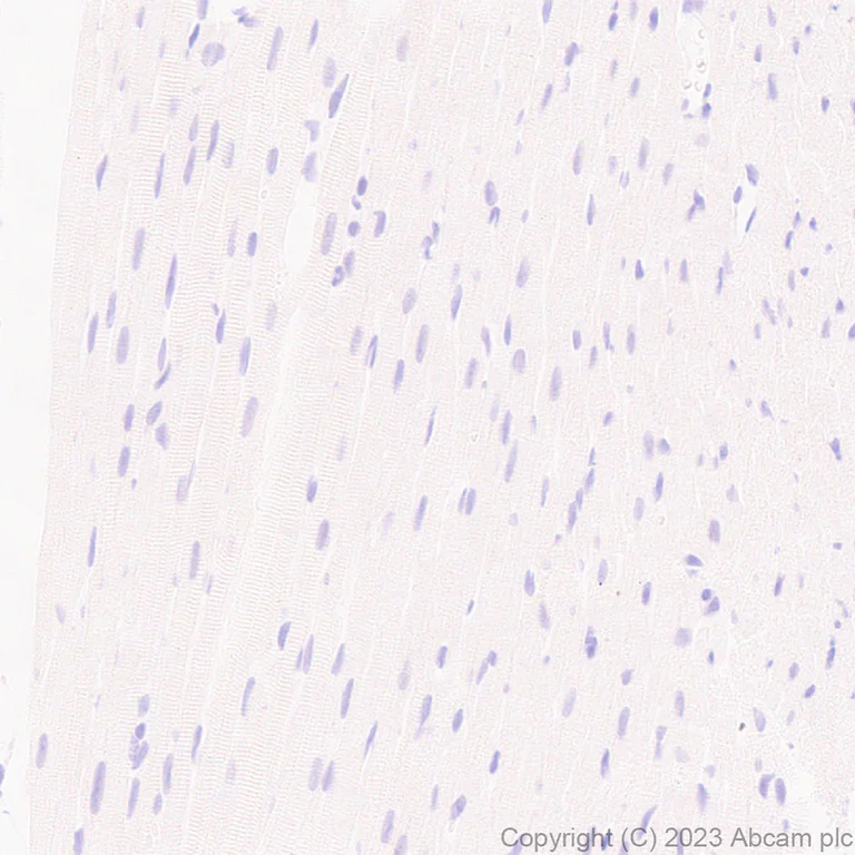 Immunohistochemistry (Formalin/PFA-fixed paraffin-embedded sections) - Anti-MATH2/NEUROD6 antibody [EPR28660-23] (AB315812)