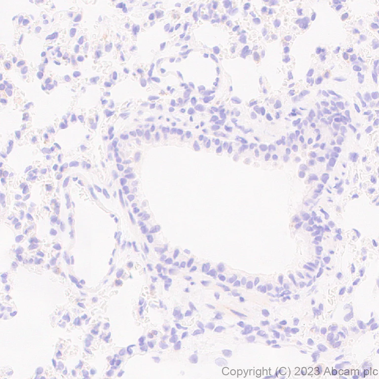 Immunohistochemistry (Formalin/PFA-fixed paraffin-embedded sections) - Anti-MATH2/NEUROD6 antibody [EPR28660-23] (AB315812)