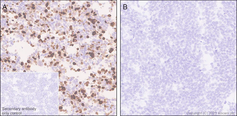 Immunohistochemistry (Formalin/PFA-fixed paraffin-embedded sections) - Anti-MATH2/NEUROD6 antibody [EPR28660-23] (AB315812)
