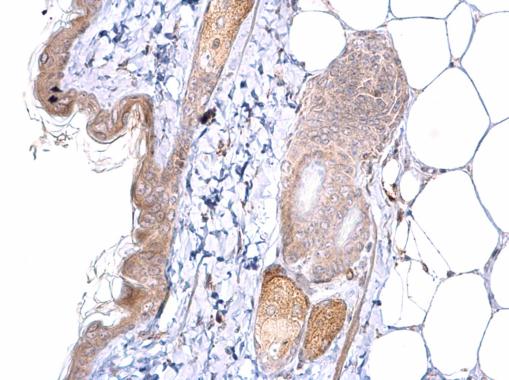 Immunohistochemistry (Formalin/PFA-fixed paraffin-embedded sections) - Anti-MATH5/ATOH7 antibody (AB229245), expandable thumbnail