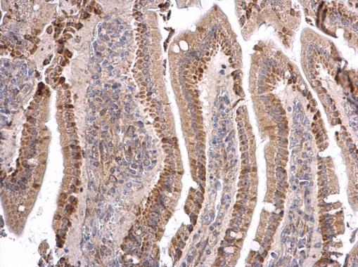 Immunohistochemistry (Formalin/PFA-fixed paraffin-embedded sections) - Anti-MATH5/ATOH7 antibody (AB229245), expandable thumbnail