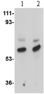 Western blot - Anti-MATN3/Matrilin-3 antibody (AB106388)