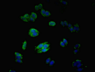 Immunocytochemistry/ Immunofluorescence - Anti-MATN3/Matrilin-3 antibody (AB238893)