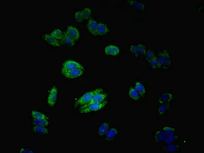 Immunocytochemistry/ Immunofluorescence - Anti-MATN3/Matrilin-3 antibody (AB238893)