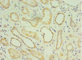 Immunohistochemistry (Formalin/PFA-fixed paraffin-embedded sections) - Anti-MATN3/Matrilin-3 antibody (AB238893)