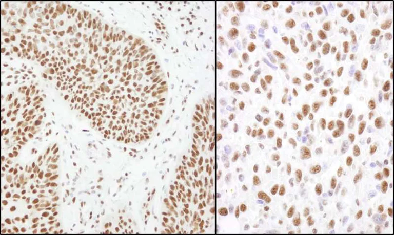 Immunohistochemistry (Formalin/PFA-fixed paraffin-embedded sections) - Anti-Matrin 3 antibody (AB264136)