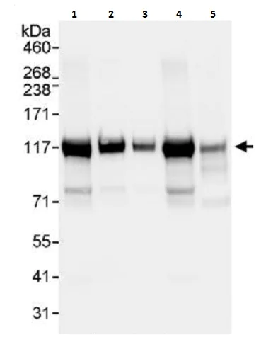 Western blot - Anti-Matrin 3 antibody (AB264136)