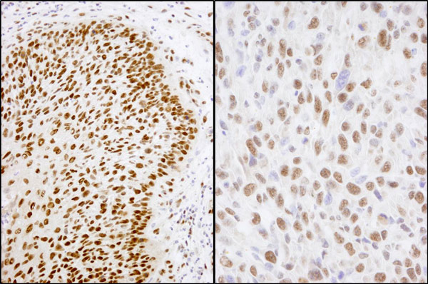 Immunohistochemistry (Formalin/PFA-fixed paraffin-embedded sections) - Anti-Matrin 3 antibody (AB70336)