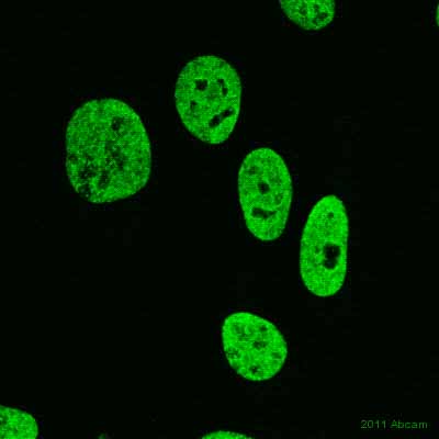 Immunocytochemistry/ Immunofluorescence - Anti-Matrin 3 antibody (AB84422), expandable thumbnail