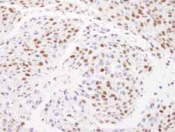 Immunohistochemistry (Formalin/PFA-fixed paraffin-embedded sections) - Anti-Matrin 3 antibody (AB84422), expandable thumbnail