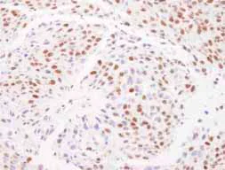 Immunohistochemistry (Formalin/PFA-fixed paraffin-embedded sections) - Anti-Matrin 3 antibody (AB84422)