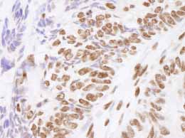 Immunohistochemistry (Formalin/PFA-fixed paraffin-embedded sections) - Anti-Matrin 3 antibody (AB84422), expandable thumbnail