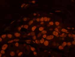 Immunohistochemistry (Formalin/PFA-fixed paraffin-embedded sections) - Anti-Matrin 3 antibody (AB84422), expandable thumbnail