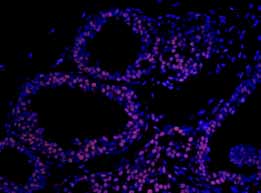 Immunohistochemistry (Formalin/PFA-fixed paraffin-embedded sections) - Anti-Matrin 3 antibody (AB84422), expandable thumbnail