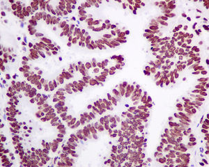 Immunohistochemistry (Formalin/PFA-fixed paraffin-embedded sections) - Anti-Matrin 3 antibody [EPR10634(B)] (AB151739)