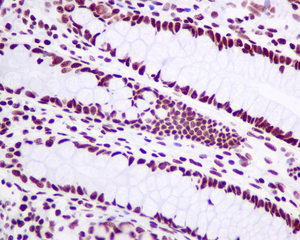 Immunohistochemistry (Formalin/PFA-fixed paraffin-embedded sections) - Anti-Matrin 3 antibody [EPR10634(B)] - BSA and Azide free (AB249054), expandable thumbnail