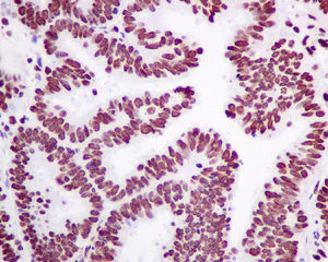 Immunohistochemistry (Formalin/PFA-fixed paraffin-embedded sections) - Anti-Matrin 3 antibody [EPR10634(B)] - BSA and Azide free (AB249054)