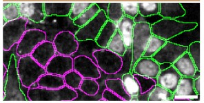 Immunocytochemistry/ Immunofluorescence - Anti-Matrin 3 antibody [EPR10635(B)] (ab151714), expandable thumbnail