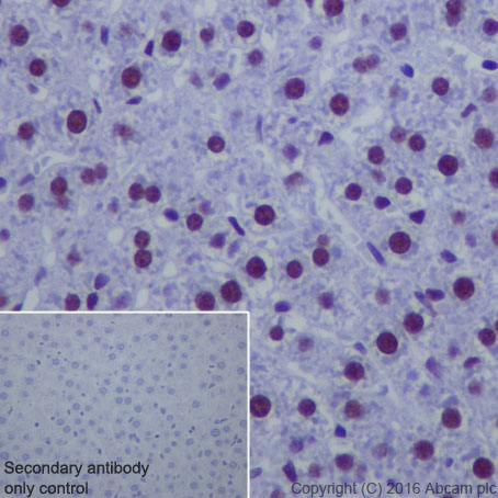 Immunohistochemistry (Formalin/PFA-fixed paraffin-embedded sections) - Anti-Matrin 3 antibody [EPR10635(B)] (ab151714), expandable thumbnail