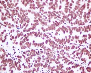 Immunohistochemistry (Formalin/PFA-fixed paraffin-embedded sections) - Anti-Matrin 3 antibody [EPR10635(B)] (ab151714), expandable thumbnail