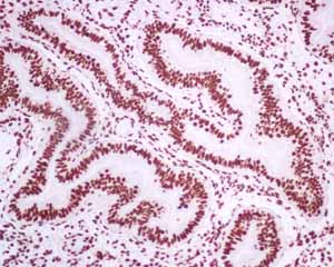 Immunohistochemistry (Formalin/PFA-fixed paraffin-embedded sections) - Anti-Matrin 3 antibody [EPR10635(B)] (ab151714), expandable thumbnail