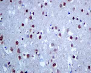 Immunohistochemistry (Formalin/PFA-fixed paraffin-embedded sections) - Anti-Matrin 3 antibody [EPR10635(B)] (ab151714), expandable thumbnail