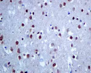 Immunohistochemistry (Formalin/PFA-fixed paraffin-embedded sections) - Anti-Matrin 3 antibody [EPR10635(B)] (AB151714)